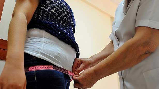 Sağlık Bakanlığı obezite rakamlarını açıkladı: Her 5 kişiden 1'i obezite