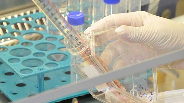 Erciyes Tıp'ta over kanserine karşı antikor üretildi