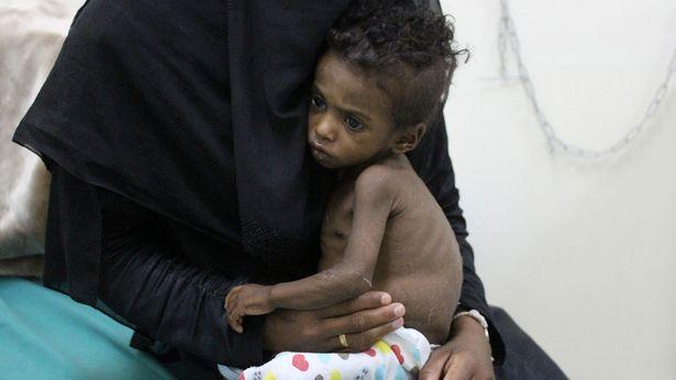 Dünya Sağlık Örgütü'nden Yemen'e tıbbi yardım