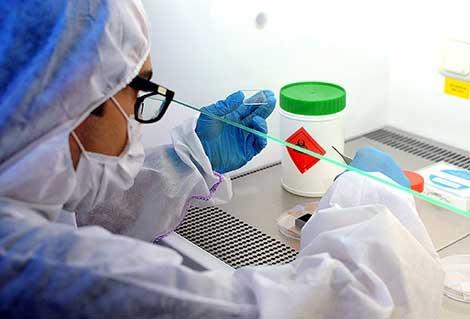 Ege Üniversitesi Kovid-19 PCR testi için yetkilendirildi