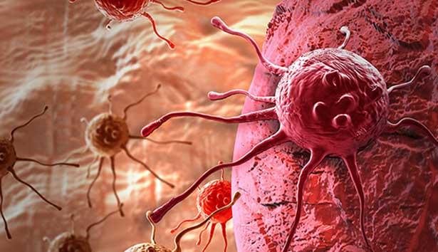 Dünyada bir ilk: Hücre tedavisi ile kanseri yendi