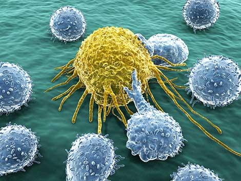 Kanser tedavisinde 'devrim niteliğinde' gelişme: Kendi T hücreleriyle tedavi
