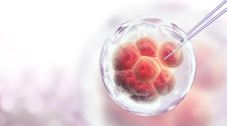 Yeni araştırma: Kök hücre tedavisi multipl skleroz tedavisinde umut vaat ediyor