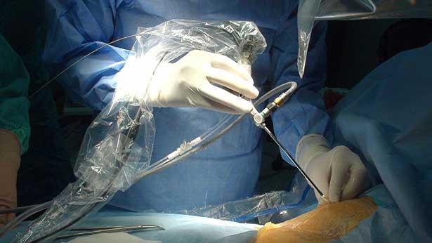 Trabzon'da Jinekolojik Laparoskopi cerrahisi masaya yatırıldı